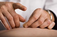 Ludlow Acupuncture and Massage   Samuel Jones Lic. Ac. (BA Hons) MFHT 724201 Image 0